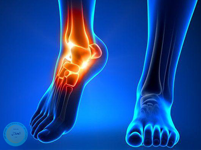 Ankle joint replacement surgery